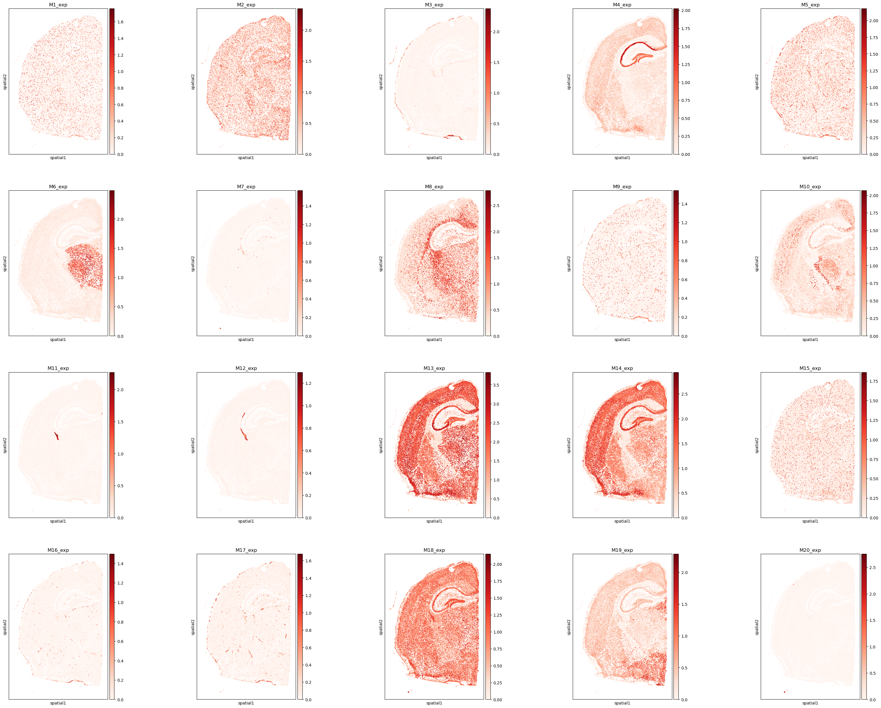 ../_images/tutorials_Tutorial_3_Xenium_Prime_5K_Mouse_Brain_22_0.png