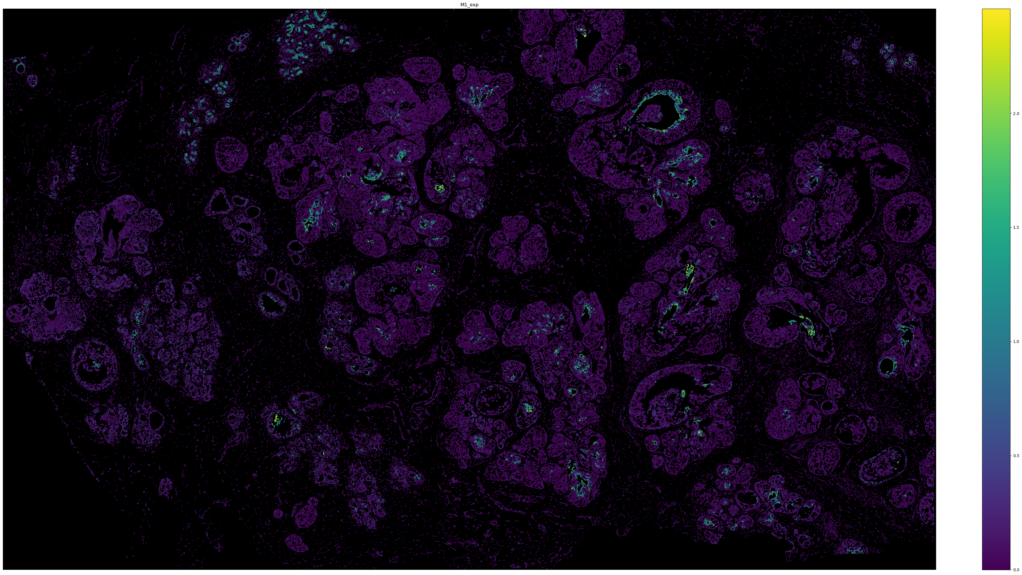 ../_images/tutorials_Tutorial_6_Atera_Breast_Tumor_20_0.png
