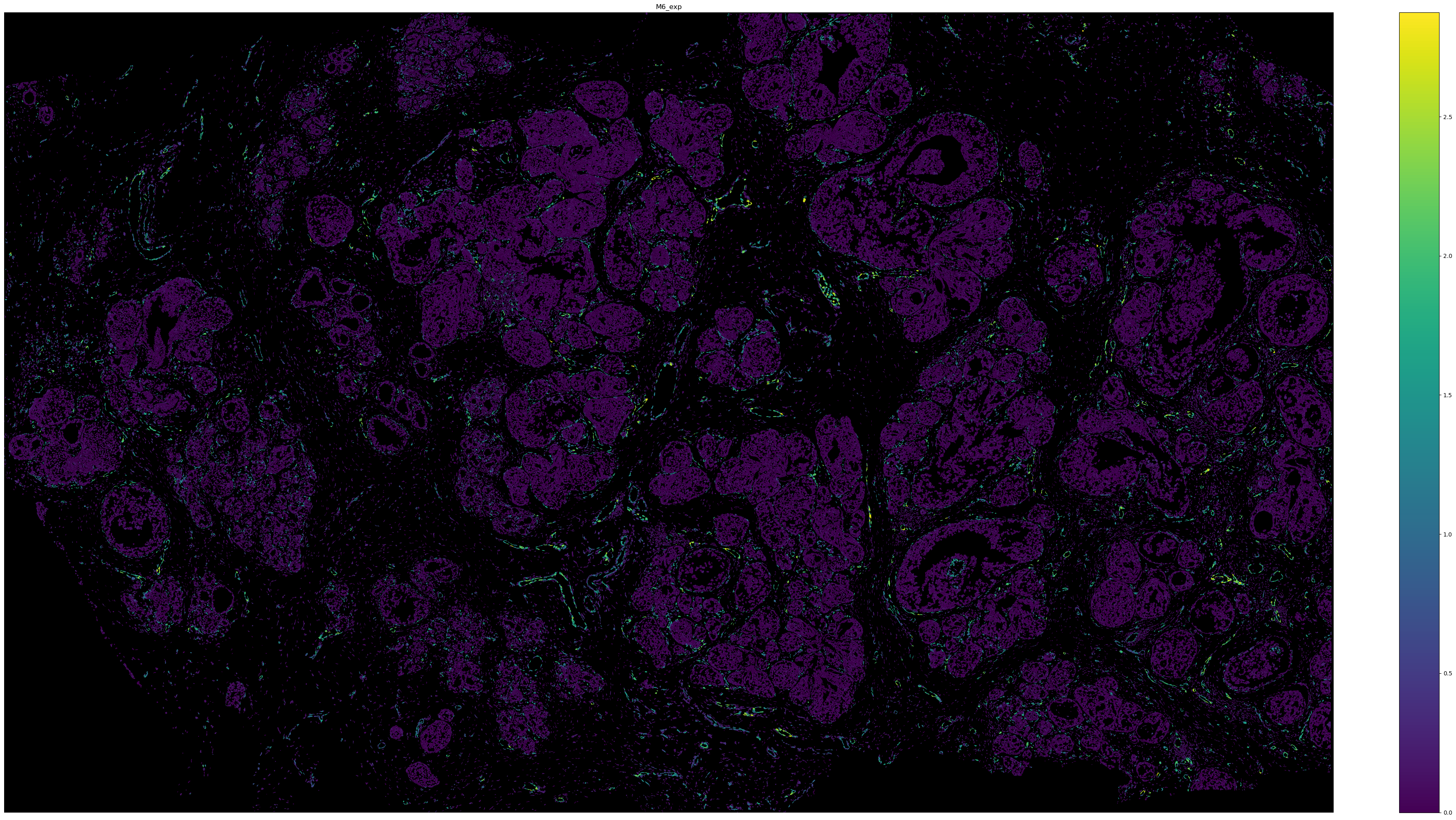 ../_images/tutorials_Tutorial_6_Atera_Breast_Tumor_21_0.png